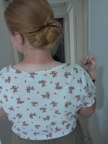 Alyssa's awsome neck sunburn